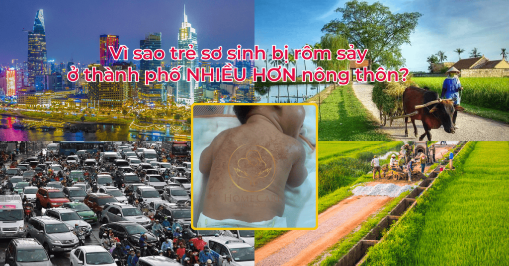 Vì sao trẻ sơ sinh bị rôm sảy ở thành phố NHIỀU HƠN nông thôn (1)