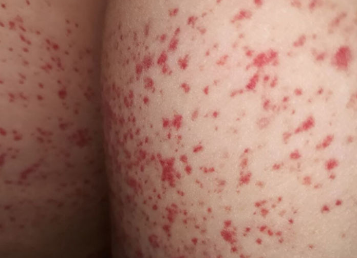 be bi rom say o mong