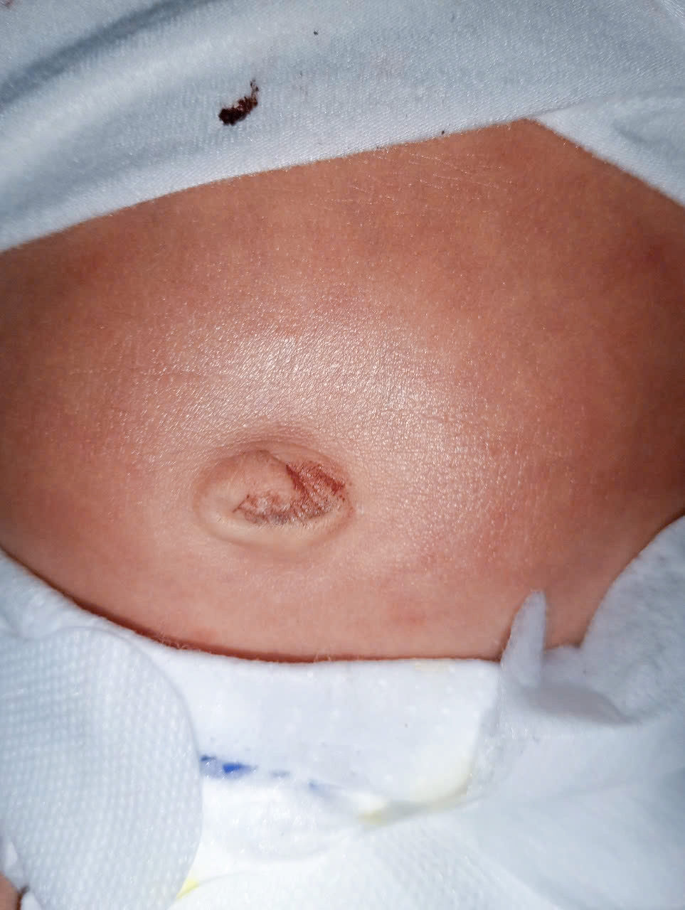 8 lưu ý vàng khi chăm sóc rốn bé sơ sinh mẹ nhất định phải biết