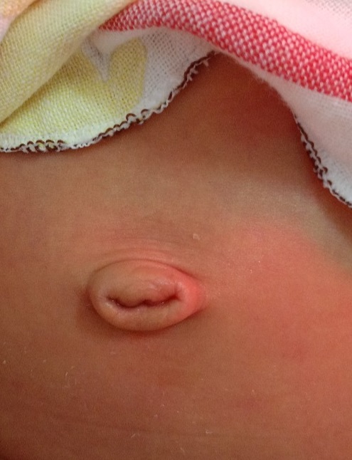 Hướng dẫn chăm sóc rốn cho trẻ sơ sinh đúng cách – An toàn