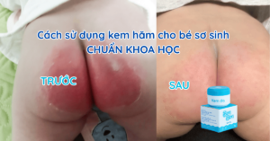 cach-su-dung-kem-ham-cho-be-so-sinh