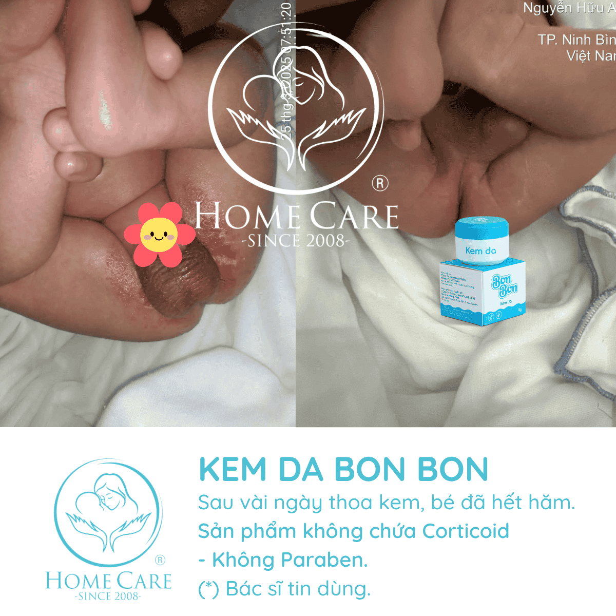 feedback-hieu-qua-kem-ham-bon-bon