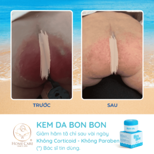 feedback-kem-da-bon-bon (3)