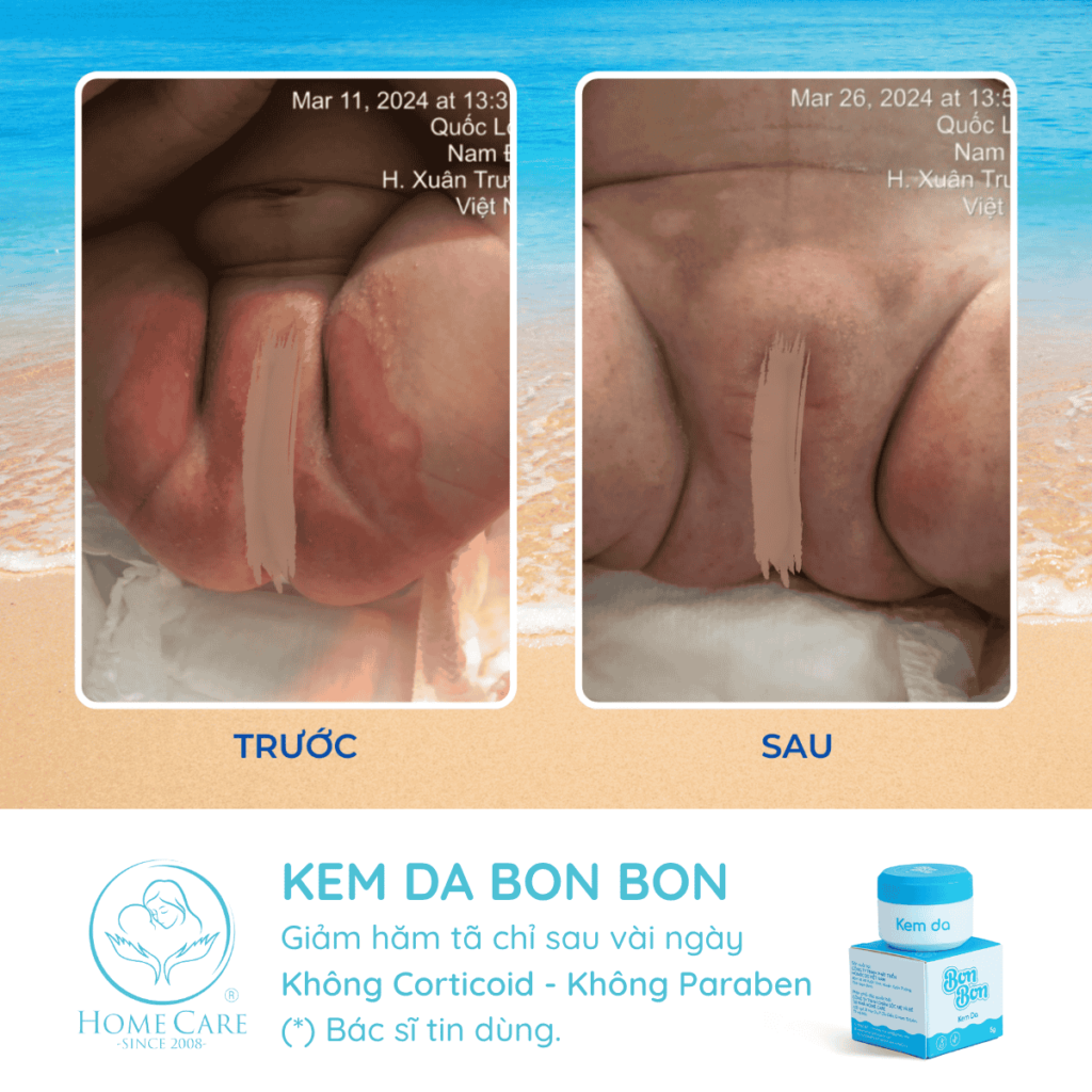 feedback-kem-ham-cho-be-bon-bon