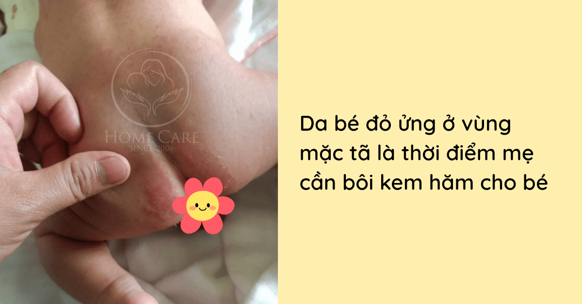 khi-nao-can-boi-kem-ham-cho-be