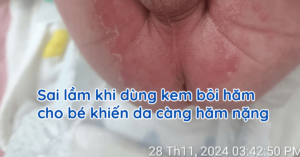 sai-lam-khi-boi-kem-ham-cho-be