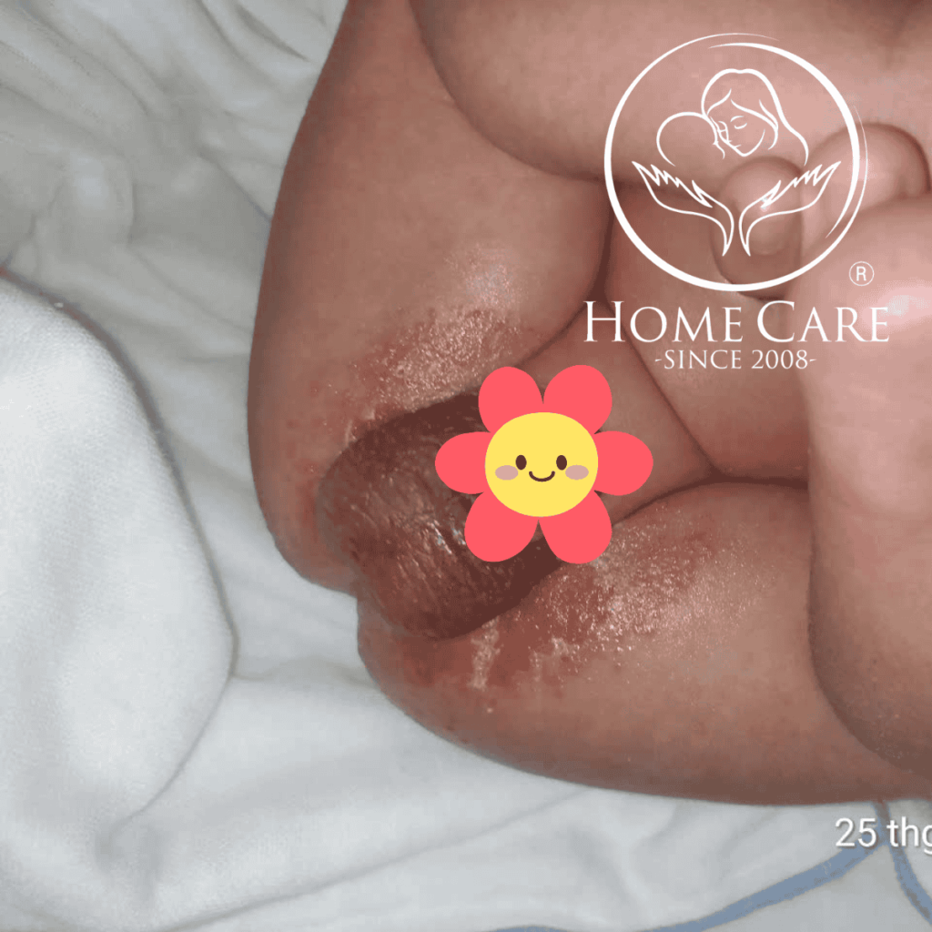 tre-so-sinh-bi-ham (1)